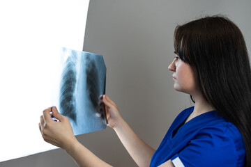 Caucasian female doctor examining Xray lungs  in clinic