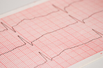 heart rhythm ekg note on paper Doctors use it to analyze heart disease treatments.