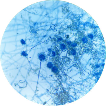 Aspergillus spp. under light microscope. (stain with lactophenol cotton blue)