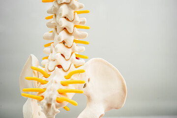 Lumbar spine displaced herniated disc fragment, spinal nerve and bone. Model for treatment medical...