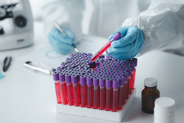 Laboratory is used for scientific research to examine and research blood obtained by sampling patients from hospital, lab assistant doing blood tests for abnormalities. Laboratory and expert concepts.