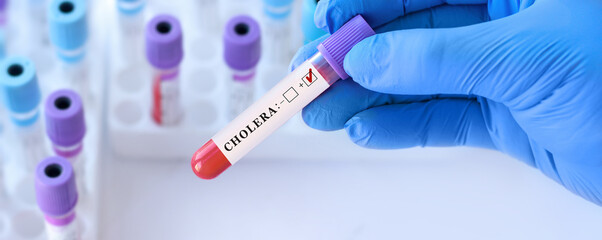 Obraz premium Doctor holding a test blood sample tube with Cholera test on the background of medical test tubes with analyzes.