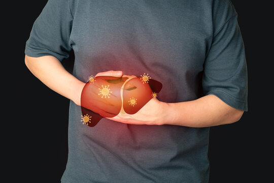 World hepatitis day concept. Man suffering from abdominal pain with liver viral infection symbol. Awareness of prevention and treatment viral hepatitis that causes liver cancer.
