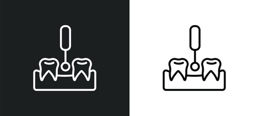 interproximal line icon in white and black colors. interproximal flat vector icon from interproximal collection for web, mobile apps and ui.