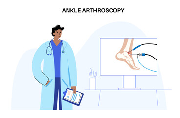 Ankle arthroscopy poster