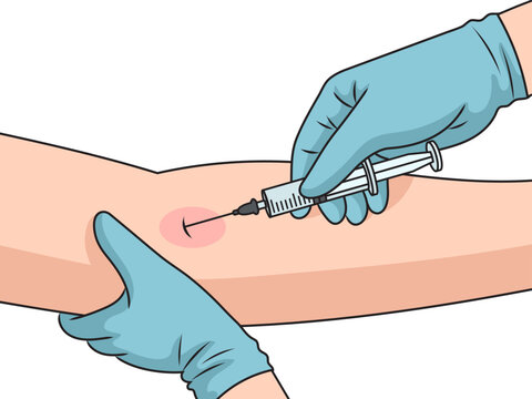 Intravenous Injection Ka Diagram