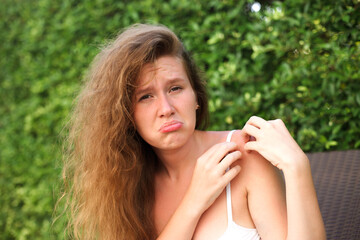 Irritated young suffering woman scratching her itching arm from a mosquito bite at the park at...