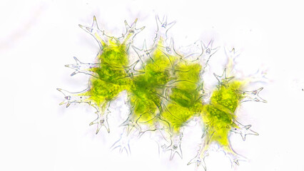 Vegetative reproduction of Staurastrum. Live cell. Selective focus image