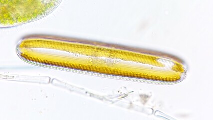 Freshwater diatom, Pinnularia sp. Live cell. Selective focus image