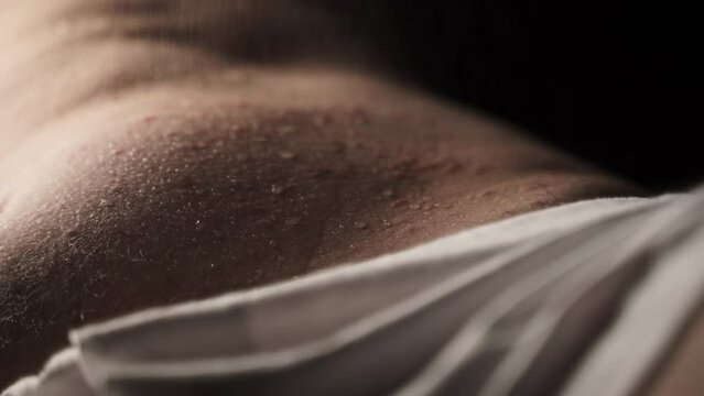 Skin with acne, pimples bite marks is sprayed with medicine, healing bruces.