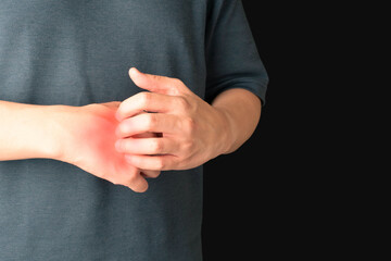 Man scratching the itch on him hands with redness rash. Cause of itchy skin include  eczema, atopic...