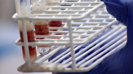 DNA laboratory old school extraction