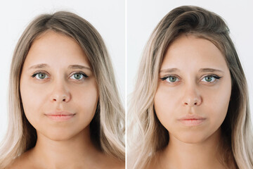 Young caucasian woman with eyes before and after blepharoplasty isolated on white background....
