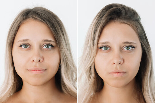 Young caucasian woman with eyes before and after blepharoplasty isolated on white background. Result of plastic surgery. Changing the shape of the eyes to almond-shaped. Comparison, difference