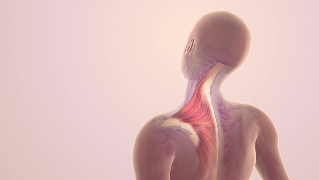 Shoulder and trapezius muscle pain