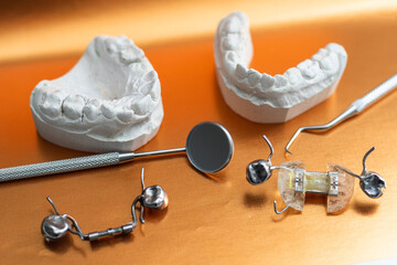 Dental casting gypsum model plaster cast stomatologic human jaws prothetic laboratory. dental plate