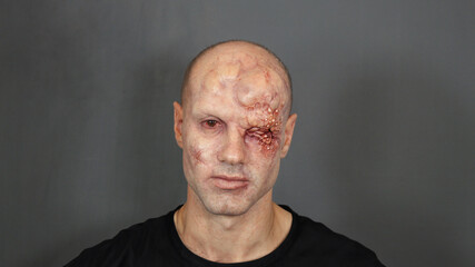 Balding Mutant Man With bad skin 
