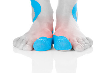 Kinesio tape on female foot isolated on white background. Chronic pain, alternative medicine. Rehabilitation and physiotherapy.