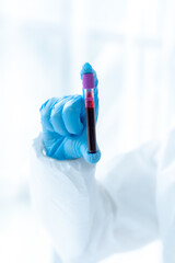 Doctor hand taking a blood sample tube from a rack with machines of analysis in the lab background,...