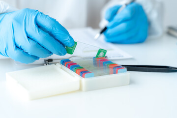 Doctor hand taking a blood sample tube from a rack with machines of analysis in the lab background,...