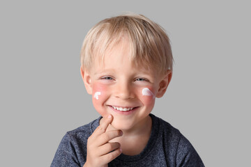 Allergic little boy with sunburned face and cream on grey background, closeup