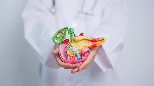 Doctor with human Pancreatitis anatomy model with Pancreas, Gallbladder, Bile Duct, Duodenum, Small intestine. Pancreatic cancer, Acute and Chronic pancreatitis,  Digestive system and Health concept