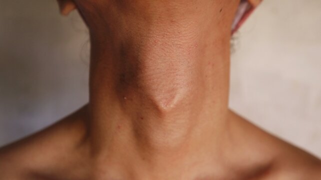 Photo of a man's Adam's apple and neck area protruding against