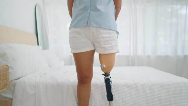 Portrait of happy asian woman amputee in leg prosthesis equipment standing with arms crossed, smiling to camera. Leg prosthetic equipment, Amputee concept