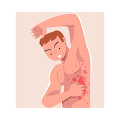 Man Character with Skin Problem Suffering Scratching Itching Body Vector Illustration