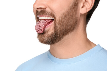 Obraz premium Dry mouth symptom. Man showing dehydrated tongue on white background, closeup