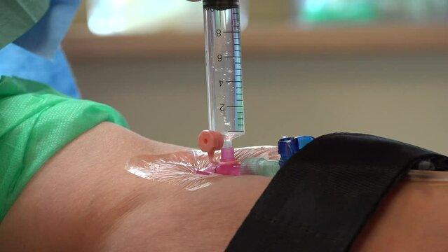 Peripheral Venous Catheter being installed