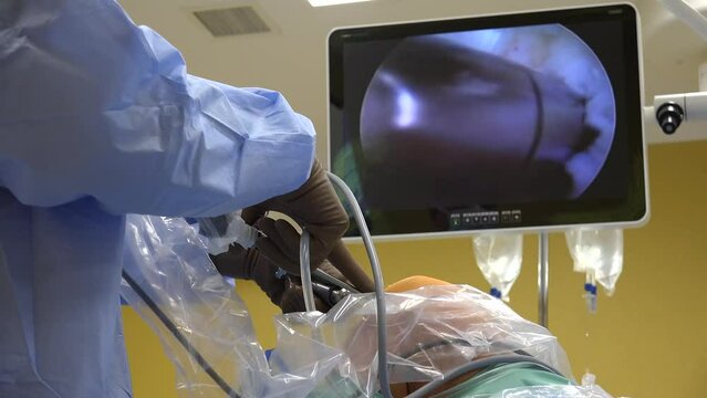 Knee Arthroscopy and shown on monitor