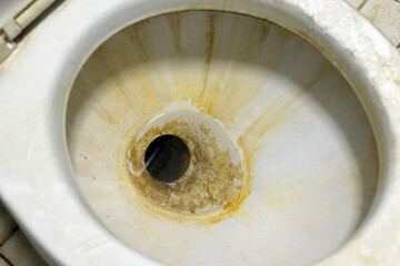 Close up shot of a dirty toilet bowl. - obrazy, fototapety, plakaty