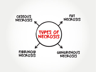 Types of Necrosis (death of body tissue) mind map text concept for presentations and reports