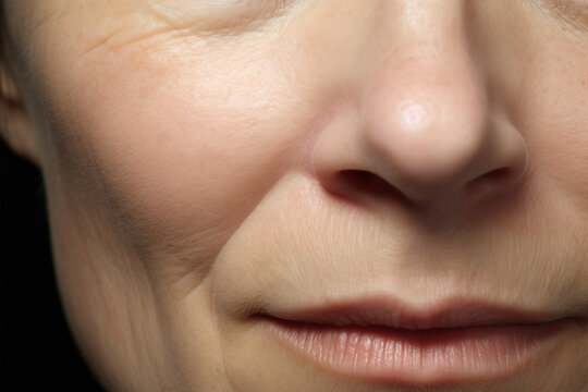 Close up of nasolabial folds around nose and mouth on middle aged woman
