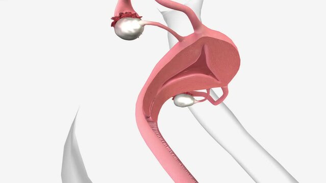 cervix is a small canal that connects your uterus and vagina