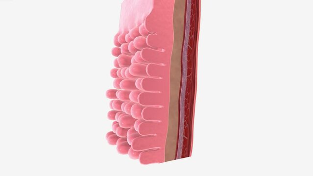 Stage 0 means that there are severely abnormal cells in the inner lining of the oesophagus