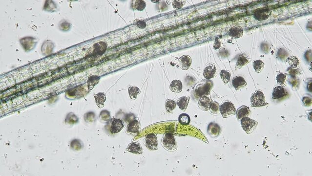 Vorticellidae colony on the Lemna root with closterium paracerosum algae in the background. Image from optical microscope with 10x objective