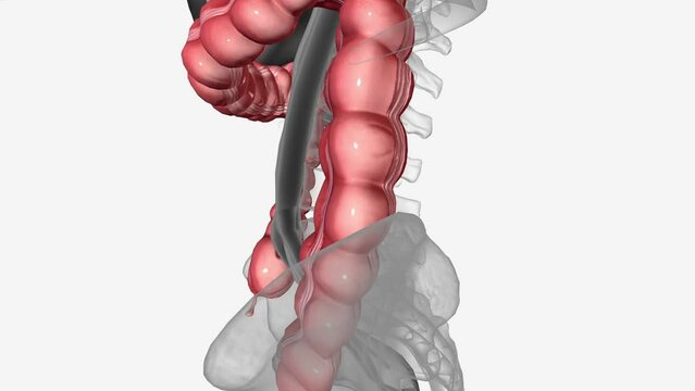 ascending colon is a retroperitoneal structure covered only on its ventral and lateral surfaces by the posterior peritoneum