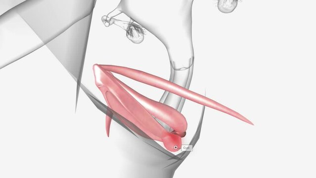 A Bartholin's cyst, also called a Bartholin's duct cyst, is a small fluid-filled sac just inside the opening of the vagina.