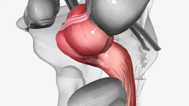 Sigmoid and Rectum, Sigmoid colon