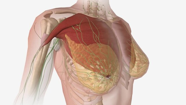 Stage 2 means the breast cancer is growing, but it is still contained in the breast or growth has only extended to the nearby lymph nodes