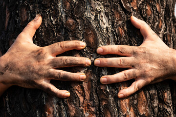 Nature lover person embracing with hands the trunk of a forest tree burned in a forest fire....