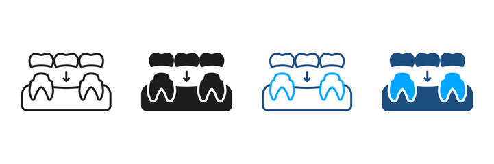 Dental Bridge Silhouette and Line Icon Set. Porcelain Denture, Tooth Regeneration Pictogram. Partial Teeth Implant Restoration. Dental Treatment Symbol Collection. Isolated Vector Illustration
