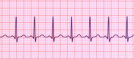 Naklejka premium Electrocardiogram ECG displaying sinus tachycardia, 3D illustration