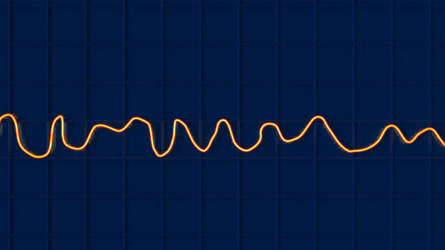 Electrocardiogram ECG displaying ventricular fibrillation rhythm, 3D illustration