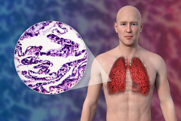 Naklejka premium A 3D illustration of the upper half part of a man with transparent skin, revealing the condition of smoker's lungs