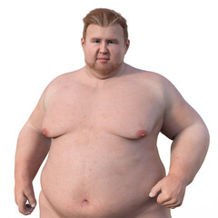 A 3D scientific illustration of an overweight white-skinned man