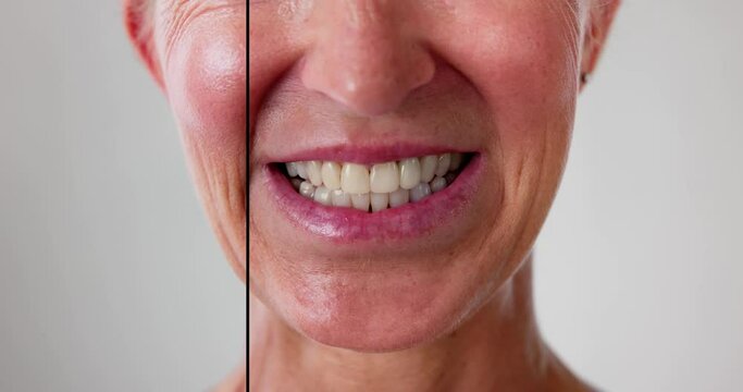 Female Teeth Between Before