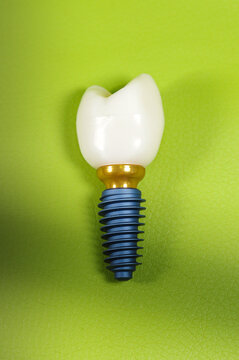 implant on green background ,
